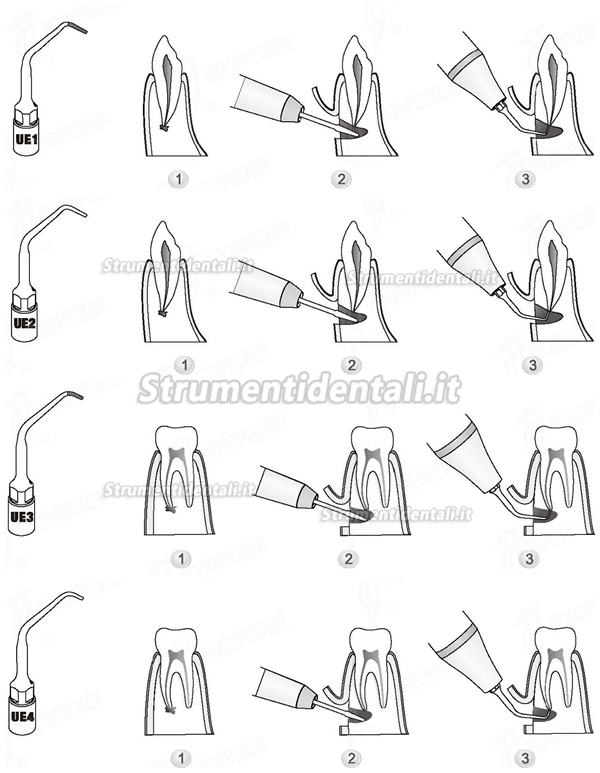 Woodpecker® Inserti Pizeo Endodonzia Chirurgia Kit 4 Inserti